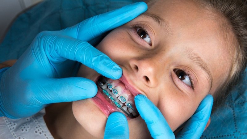 Teen Orthodontics